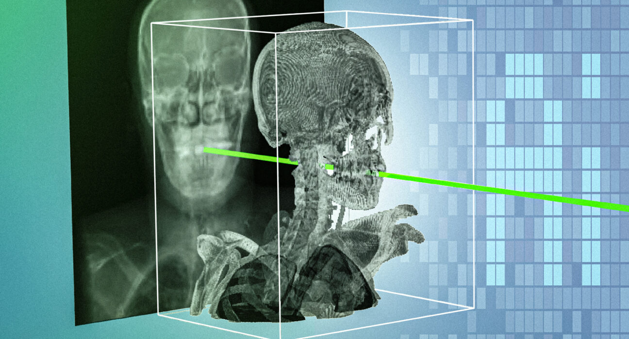 New AI technique could make minimally invasive surgeries safer and more precise | MIT News