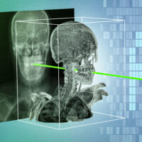 New AI technique could make minimally invasive surgeries safer and more precise | MIT News