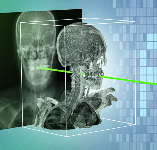 New AI technique could make minimally invasive surgeries safer and more precise | MIT News