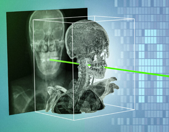 New AI technique could make minimally invasive surgeries safer and more precise | MIT News
